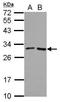 IZUMO1 Receptor, JUNO antibody, GTX124270, GeneTex, Western Blot image 