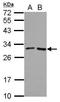 Probable folate receptor delta antibody, GTX124270, GeneTex, Western Blot image 