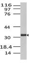 C-Type Lectin Domain Containing 6A antibody, MBS668001, MyBioSource, Western Blot image 