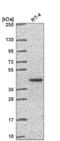 Poly(rC)-binding protein 1 antibody, NBP2-57878, Novus Biologicals, Western Blot image 