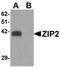 Zinc transporter ZIP2 antibody, NBP1-76499, Novus Biologicals, Western Blot image 