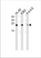 High Mobility Group Box 2 antibody, TA324905, Origene, Western Blot image 