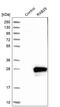 Ras-related protein Rab-7L1 antibody, HPA026303, Atlas Antibodies, Western Blot image 