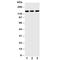 ATP Binding Cassette Subfamily B Member 11 antibody, R30464, NSJ Bioreagents, Western Blot image 