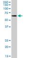 Solute Carrier Family 17 Member 4 antibody, H00010050-M03, Novus Biologicals, Western Blot image 