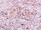 Claudin 14 antibody, orb182915, Biorbyt, Immunohistochemistry paraffin image 