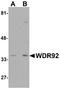 WD Repeat Domain 92 antibody, NBP1-76282, Novus Biologicals, Western Blot image 