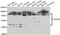 Trimethyllysine Hydroxylase, Epsilon antibody, abx005519, Abbexa, Western Blot image 