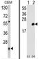 Peroxiredoxin-1 antibody, AP17660PU-N, Origene, Western Blot image 