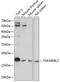 TNF Alpha Induced Protein 8 Like 2 antibody, GTX66198, GeneTex, Western Blot image 
