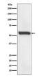 Formimidoyltransferase Cyclodeaminase antibody, M05499, Boster Biological Technology, Western Blot image 