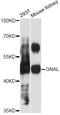 G Protein Subunit Alpha L antibody, LS-C747874, Lifespan Biosciences, Western Blot image 