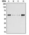 Arrestin Beta 1 antibody, orb213585, Biorbyt, Western Blot image 