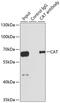 Catalase antibody, GTX64374, GeneTex, Immunoprecipitation image 