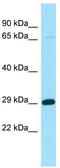 StAR Related Lipid Transfer Domain Containing 6 antibody, TA337906, Origene, Western Blot image 