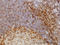 Src Kinase Associated Phosphoprotein 1 antibody, LS-C133559, Lifespan Biosciences, Immunohistochemistry paraffin image 