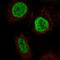 YTH Domain Containing 2 antibody, NBP2-57606, Novus Biologicals, Immunocytochemistry image 
