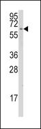 Cytochrome P450 Family 1 Subfamily A Member 1 antibody, GTX81232, GeneTex, Western Blot image 