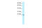 General Transcription Factor IIF Subunit 2 antibody, 27-344, ProSci, Immunohistochemistry paraffin image 