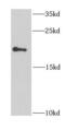 Eukaryotic Translation Initiation Factor 1A Y-Linked antibody, FNab02687, FineTest, Western Blot image 
