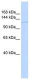 TATA-Box Binding Protein Associated Factor 2 antibody, TA334029, Origene, Western Blot image 