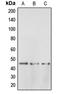 Bombesin Receptor Subtype 3 antibody, LS-C351893, Lifespan Biosciences, Western Blot image 