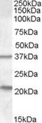 Tumor Suppressor Candidate 3 antibody, TA303338, Origene, Western Blot image 