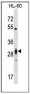 Pleckstrin Homology And FYVE Domain Containing 2 antibody, AP53349PU-N, Origene, Western Blot image 