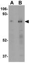 RAN Binding Protein 10 antibody, GTX31986, GeneTex, Western Blot image 
