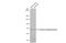 Choline O-Acetyltransferase antibody, GTX113164, GeneTex, Western Blot image 