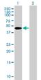 Zinc Finger And BTB Domain Containing 37 antibody, H00084614-B01P, Novus Biologicals, Western Blot image 