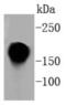 Integrin Subunit Alpha L antibody, NBP2-67551, Novus Biologicals, Western Blot image 