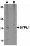 Synaptophysin Like 1 antibody, orb94296, Biorbyt, Western Blot image 