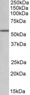 G Protein Subunit Beta 3 antibody, 42-684, ProSci, Western Blot image 