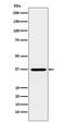 Cone-Rod Homeobox antibody, M02202, Boster Biological Technology, Western Blot image 