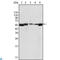 LYN Proto-Oncogene, Src Family Tyrosine Kinase antibody, LS-C812812, Lifespan Biosciences, Western Blot image 