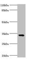 Transmembrane And Coiled-Coil Domains 5A antibody, orb357143, Biorbyt, Western Blot image 