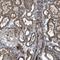 Transmembrane Protein 132C antibody, NBP1-90497, Novus Biologicals, Immunohistochemistry paraffin image 