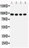 ADAM Metallopeptidase Domain 17 antibody, PA1844, Boster Biological Technology, Western Blot image 