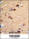 Unc-5 Netrin Receptor C antibody, 62-537, ProSci, Immunohistochemistry paraffin image 