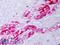 Crystallin Alpha B antibody, LS-C231319, Lifespan Biosciences, Immunohistochemistry frozen image 