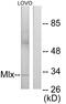 MAX Dimerization Protein MLX antibody, GTX87667, GeneTex, Western Blot image 