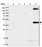 TRNA Methyltransferase 2 Homolog B antibody, NBP1-85370, Novus Biologicals, Western Blot image 