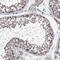 Protein Phosphatase 2 Regulatory Subunit B'Delta antibody, HPA029045, Atlas Antibodies, Immunohistochemistry frozen image 