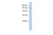 Diphosphoinositol Pentakisphosphate Kinase 2 antibody, A08164, Boster Biological Technology, Western Blot image 