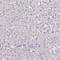 DNA Polymerase Beta antibody, NBP2-38600, Novus Biologicals, Immunohistochemistry paraffin image 