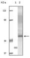 AKT Serine/Threonine Kinase 3 antibody, 32-106, ProSci, Enzyme Linked Immunosorbent Assay image 