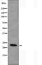 NADH:Ubiquinone Oxidoreductase Subunit B9 antibody, orb226578, Biorbyt, Western Blot image 