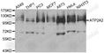ATPase Sarcoplasmic/Endoplasmic Reticulum Ca2+ Transporting 2 antibody, A1097, ABclonal Technology, Western Blot image 