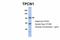 Two Pore Segment Channel 1 antibody, A05866, Boster Biological Technology, Western Blot image 